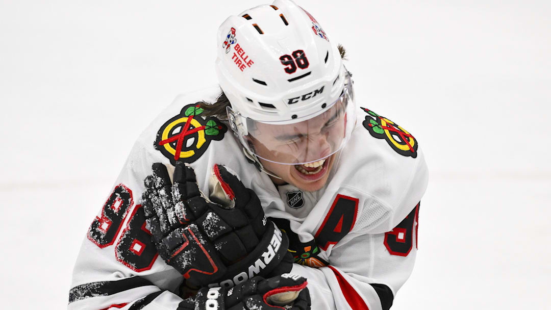 Dec 12, 2025; St. Louis, Missouri, USA; Chicago Blackhawks center Connor Bedard (98) reacts in pain after a face off against St. Louis Blues center Brayden Schenn (not pictured) during the third period at Enterprise Center. Mandatory Credit: Jeff Curry-Imagn Images