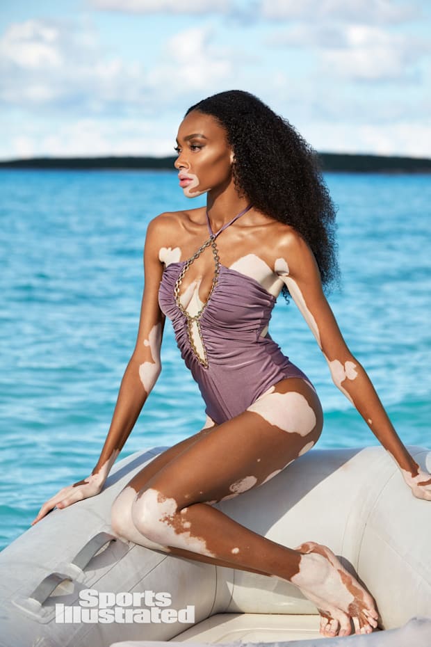 Winnie Harlow