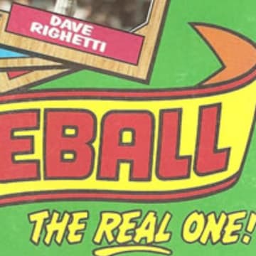1987 Topps box