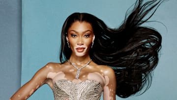 Winnie Harlow was photographed by Yu Tsai in Hollywood, Fla. 