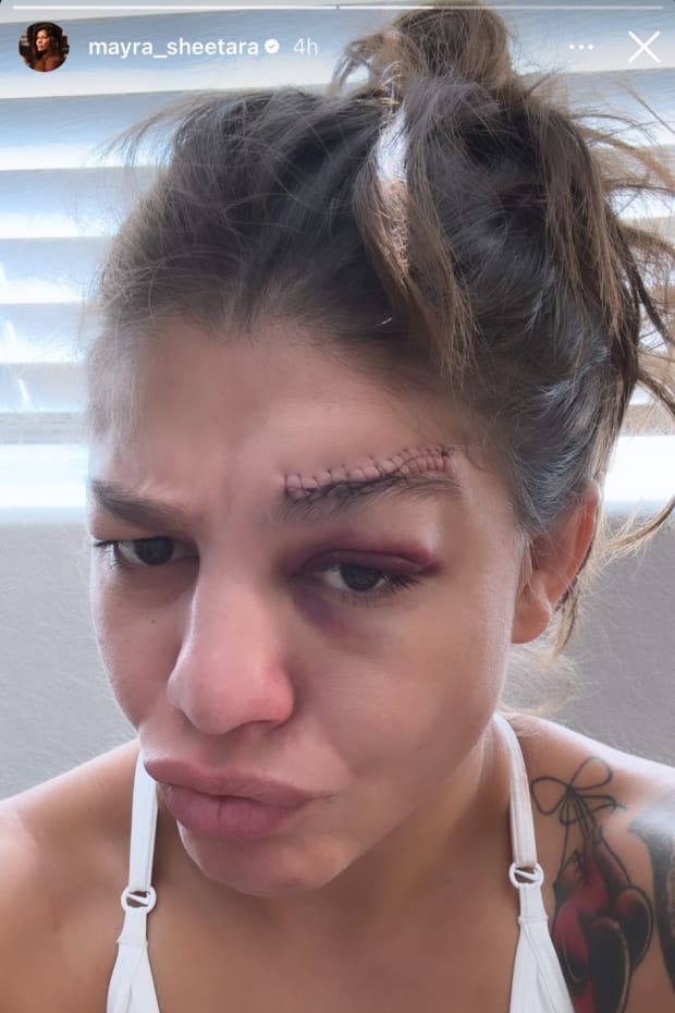 Mayra Bueno Silva injury UFC 303