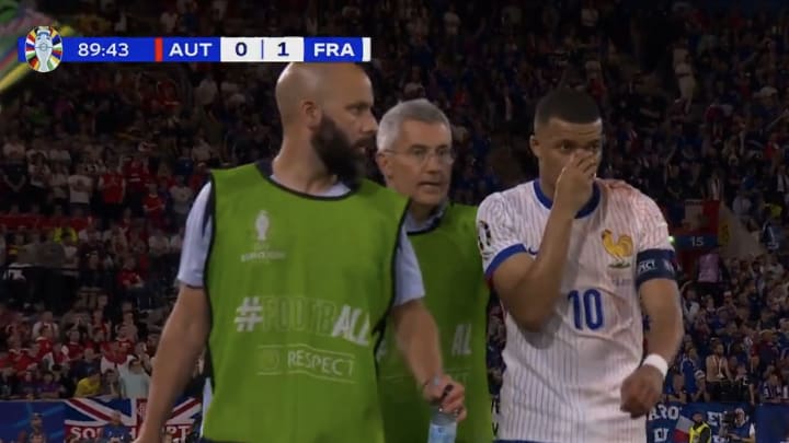 France captain Kylian Mbappe walks off the field after suffering an injury to his nose against Austria at Euro 2024. 