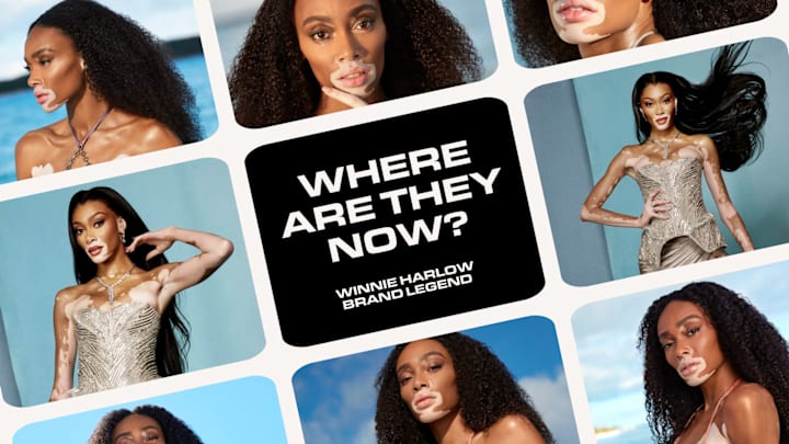 Winnie Harlow Winnie Harlow