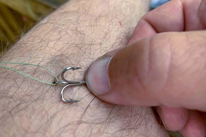 How to Remove a Fishhook From Your Skin: Simple, Safe, and Effective Methods