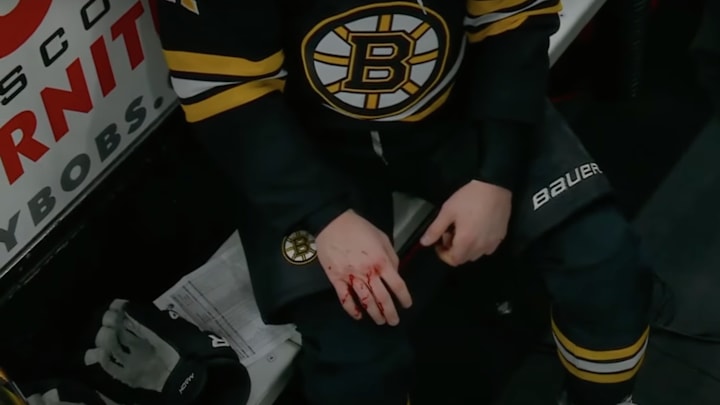 Trent Frederic’s bloody knuckles after a tilt with Corey Perry.