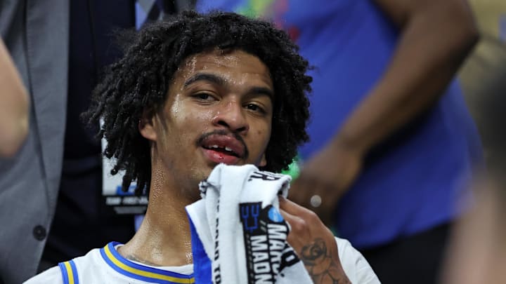 Mar 20, 2026; Philadelphia, PA, USA; UCLA Bruins guard Skyy Clark (55) reacts after having his tooth knocked out against the UCF Knights in the second half during a first round game of the men's 2026 NCAA Tournament at Xfinity Mobile Arena. Mandatory Credit: Bill Streicher-Imagn Images Mar 20, 2026; Philadelphia, PA, USA; UCLA Bruins guard Skyy Clark (55) reacts after having his tooth knocked out against the UCF Knights in the second half during a first round game of the men's 2026 NCAA Tournament at Xfinity Mobile Arena. Mandatory Credit: Bill Streicher-Imagn Images