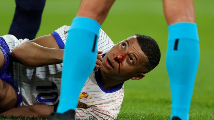 Austria  v France -EURO