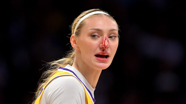 Sep 11, 2025; Los Angeles, California, USA;  Los Angeles Sparks forward Cameron Brink (22) left the game with a bloddy nose after going for a rebound in the first half against the Las Vegas Aces at Crypto.com Arena. Mandatory Credit: Jayne Kamin-Oncea-Imagn Images
