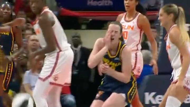 Clark took contact to the face from Sheldon during the third quarter. 