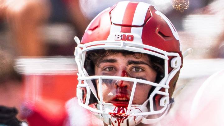 Indiana's Josh Hoover (10), bloodied, during the Indiana versus North Texas football game at Memorial Stadium on Saturday, Sept. 5, 2026. Indiana's Josh Hoover (10), bloodied, during the Indiana versus North Texas football game at Memorial Stadium on Saturday, Sept. 5, 2026.