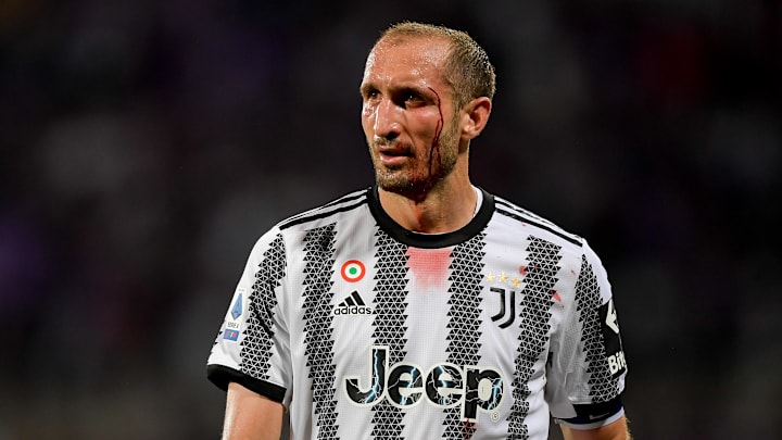 La Juventus s'est inclinée ce samedi face à la Fiorentina