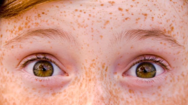 Red hair and freckles are two traits partially determined by genes.