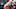 Matt Lee, Miami Hurricanes Matt Lee, Miami Hurricanes