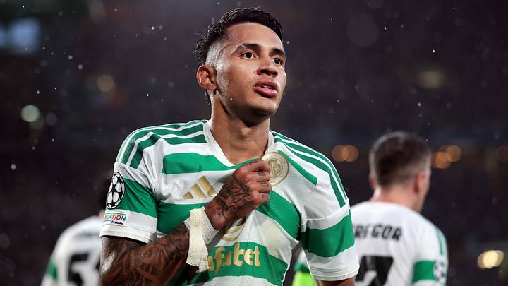 Celtic v LASK - UEFA Champions League 2026/27 Play-Offs First Leg Celtic v LASK - UEFA Champions League 2026/27 Play-Offs First Leg