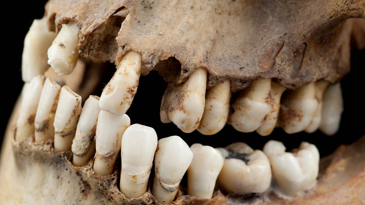 From Ashes to Urine: The Disturbing Truth About Toothpaste in Ancient ...