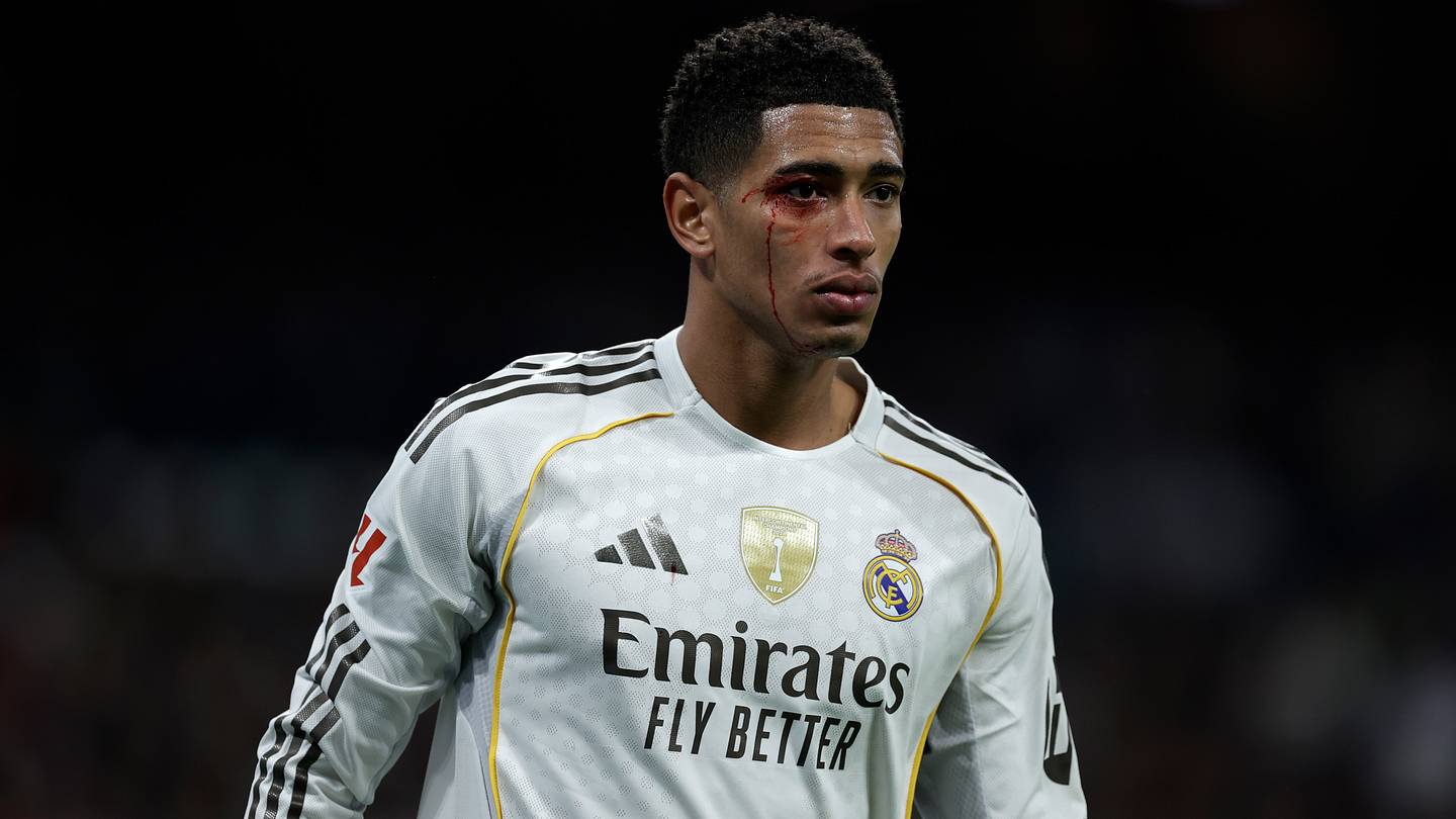 Lesionados y sancionados del Real Madrid para enfrentarse a Osasuna