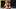 Conor McGregor UFC Return Ends After Brutal Leg Injury at UFC 329