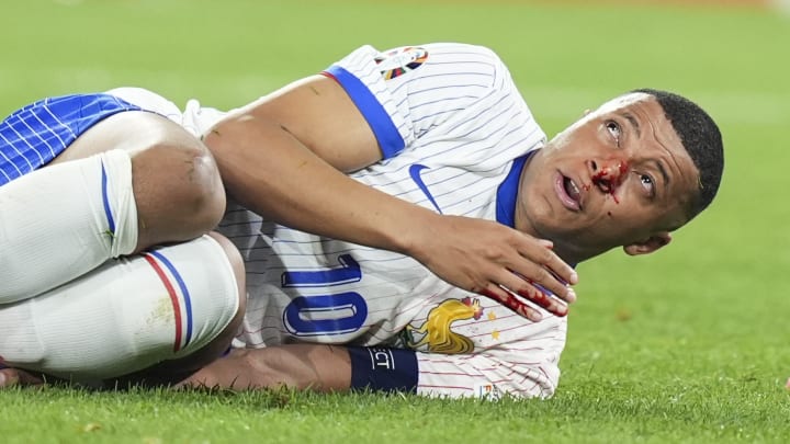 Kylian Mbappé, blessé au nez contre l'Autriche.