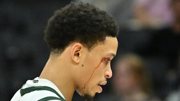 Milwaukee Bucks guard Ryan Rollins walks off the court as blood rolls down his face from his eye against the Oklahoma City Thunder during the second half at Fiserv Forum on October 14. Milwaukee Bucks guard Ryan Rollins walks off the court as blood rolls down his face from his eye against the Oklahoma City Thunder during the second half at Fiserv Forum on October 14.