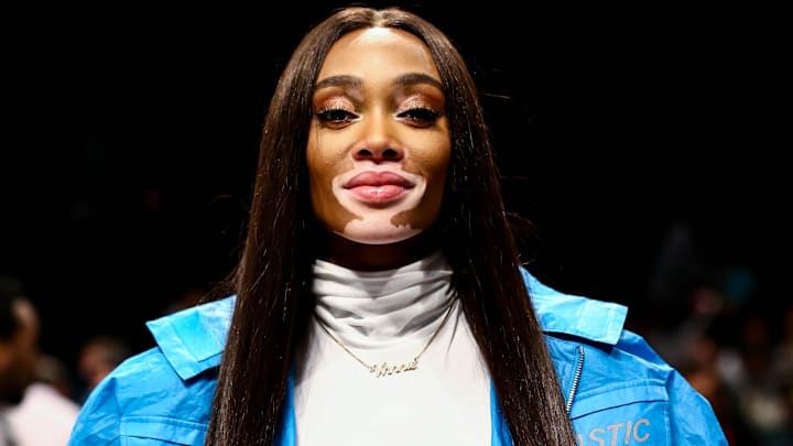 Model Winnie Harlow attends the game between the Los Angeles Clippers and the Brooklyn Nets at Barclays Center. 
