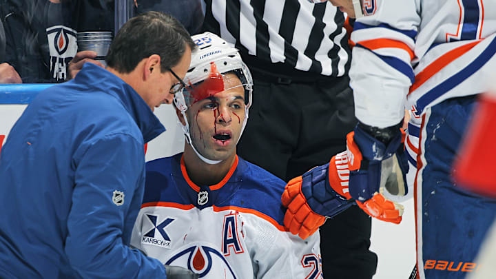 Edmonton Oilers blue liner Darnell Nurse could miss some time following the vicious hit from Leafs' enforcer Ryan Reaves.