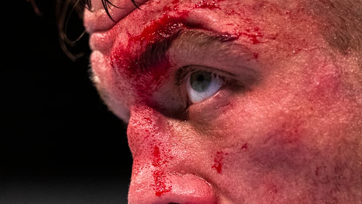 UFC Fight Night Dos Anjos v Lee
