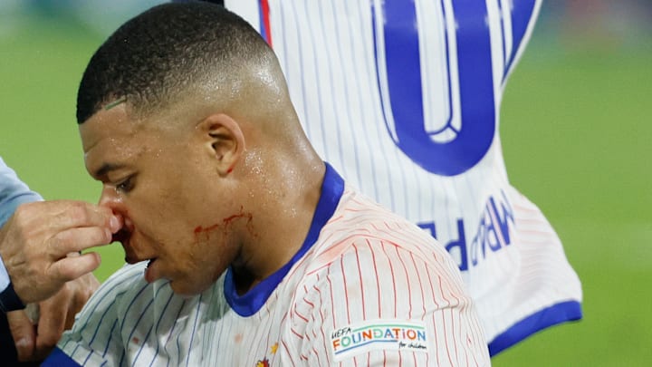Ca sent mauvais pour Mbappé, touché au nez