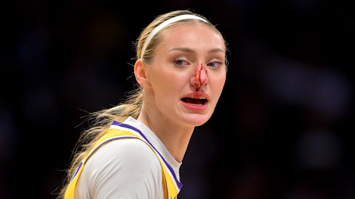 Sep 11, 2025; Los Angeles, California, USA;  Los Angeles Sparks forward Cameron Brink (22) left the game with a bloddy nose after going for a rebound in the first half against the Las Vegas Aces at Crypto.com Arena. Mandatory Credit: Jayne Kamin-Oncea-Imagn Images
