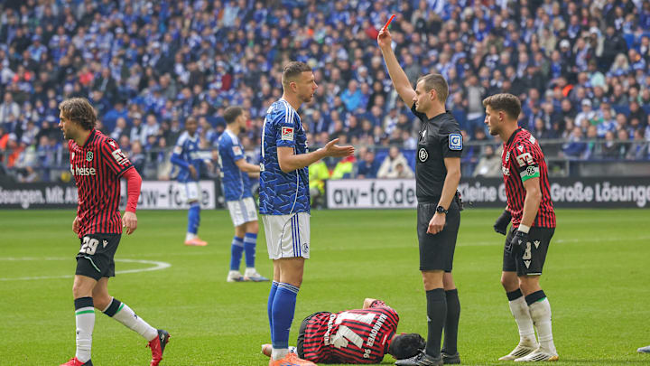 Bitterer Moment: Dzeko kassiert die Rote Karte