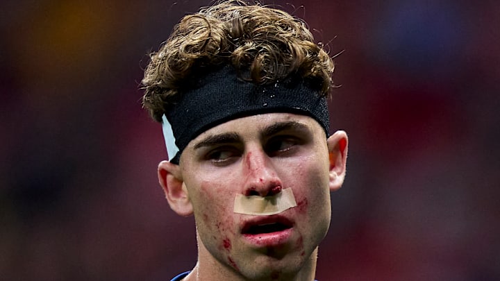 Fermin Lopez a été blessé au visage en Ligue des Champions.