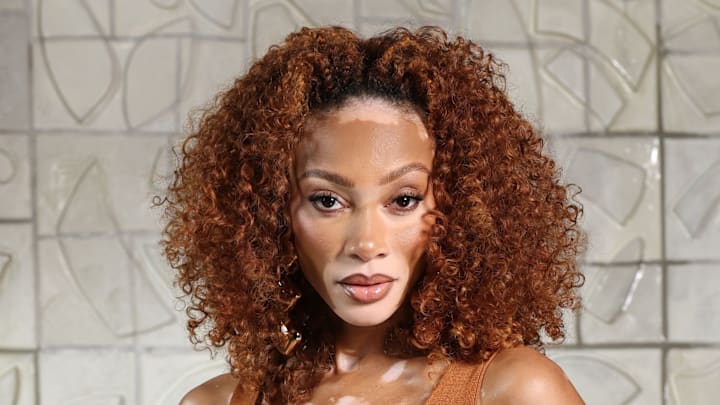 Winnie Harlow Winnie Harlow