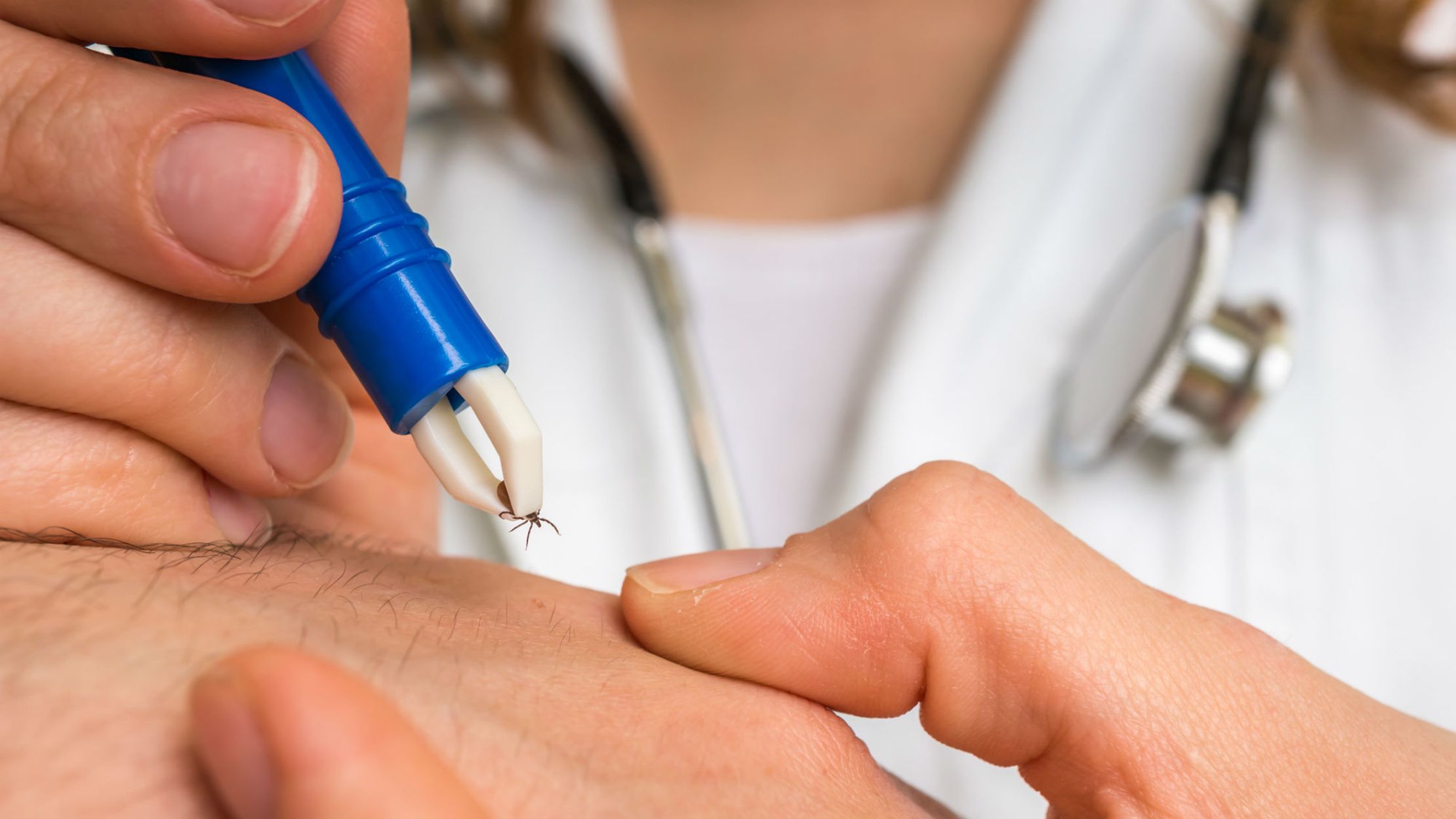 The Real Reason the Lyme Disease Vaccine Had No Shot Mental Floss