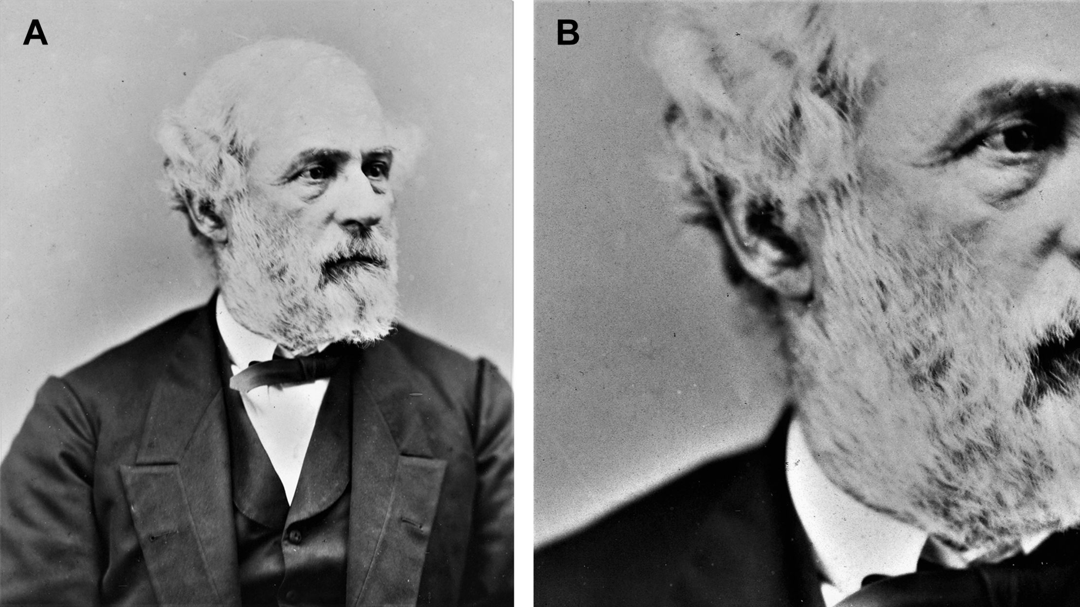 The Key to Robert E. Lee's Puzzling Death Might Be Hidden in a Photo of