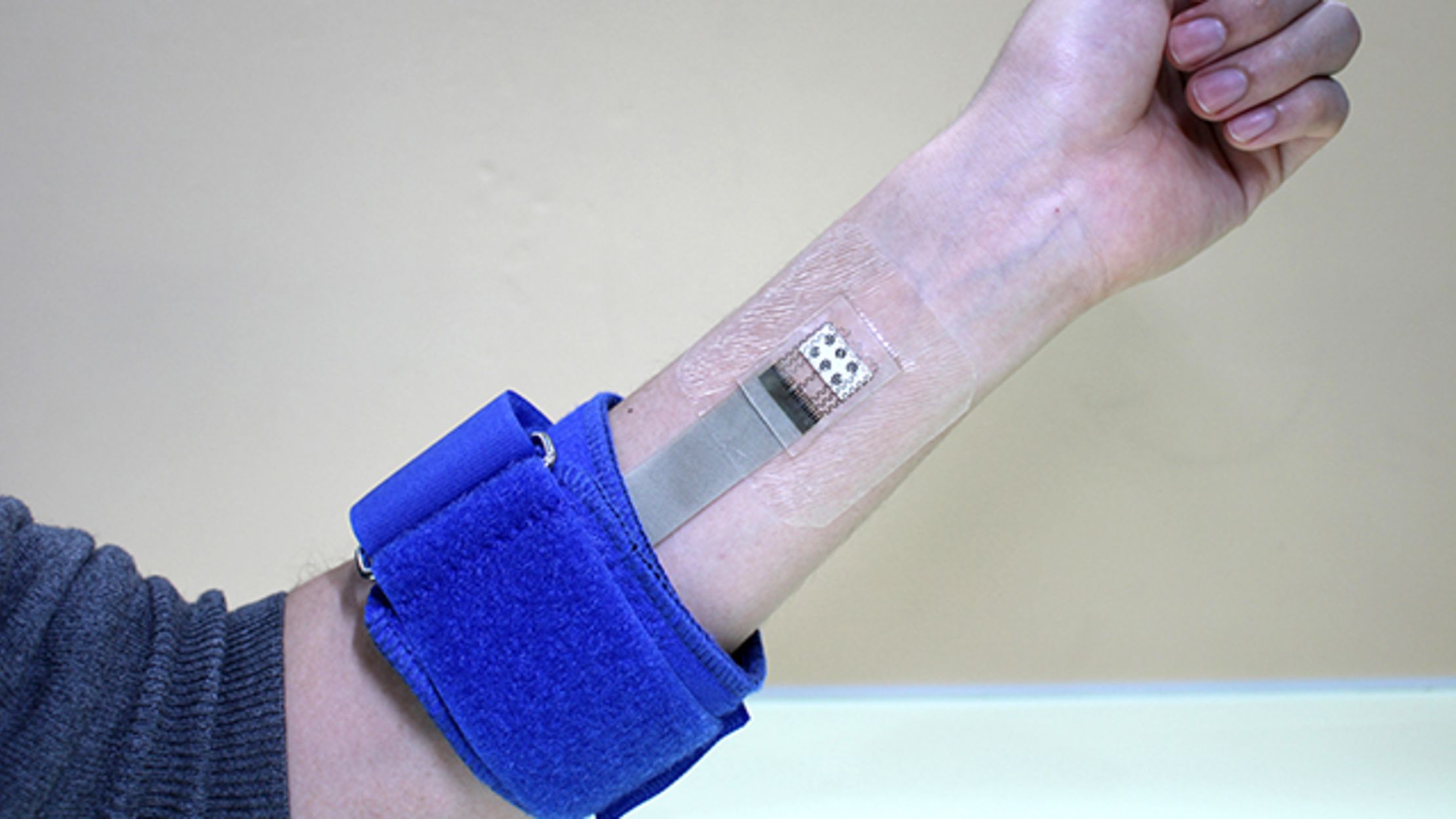 New Skin Patch Monitors Glucose and Delivers Diabetes Drugs Mental Floss