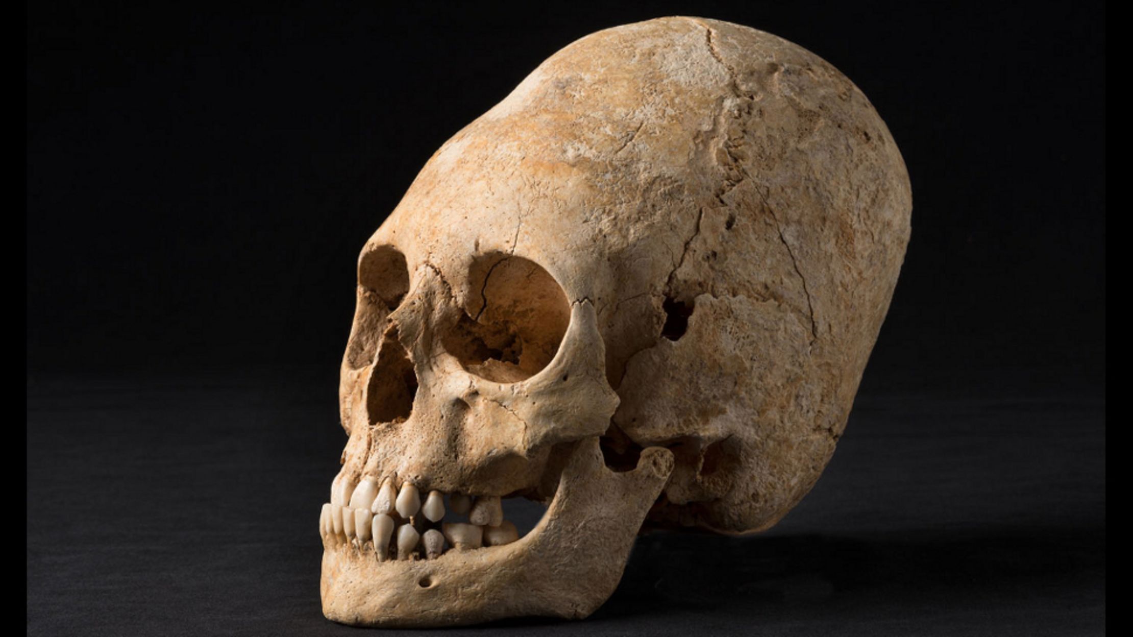 flat head skull