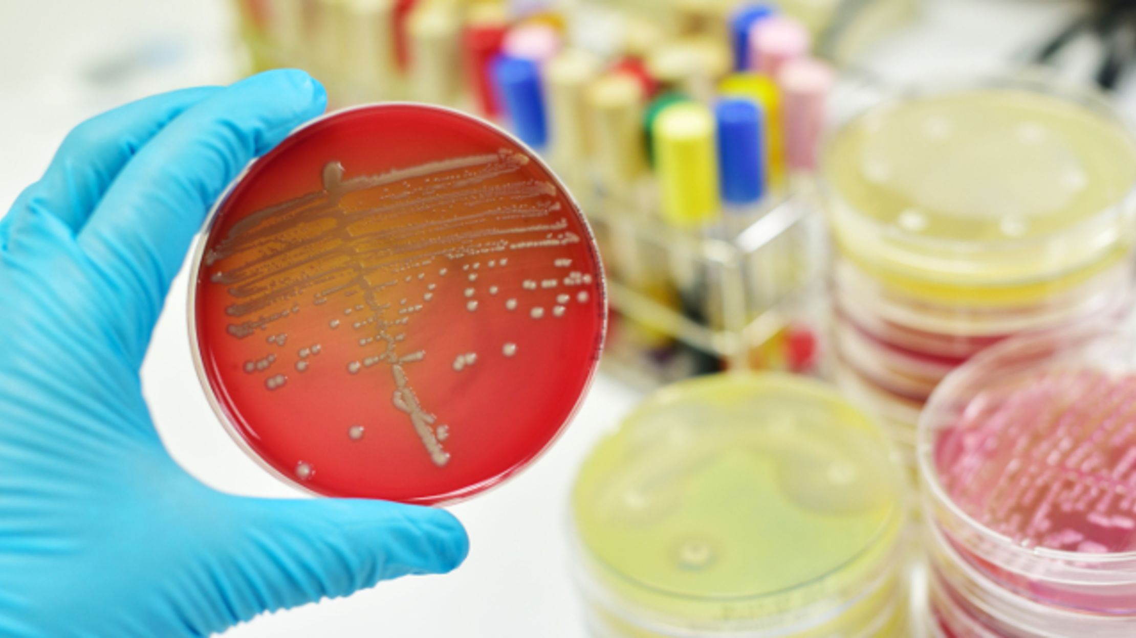 5 Ways a PostAntibiotic Era Could Change Medicine Mental Floss