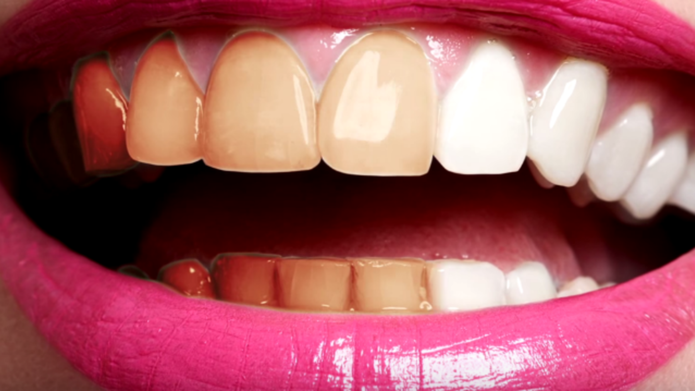 How Do Teeth Whiteners Work? Mental Floss