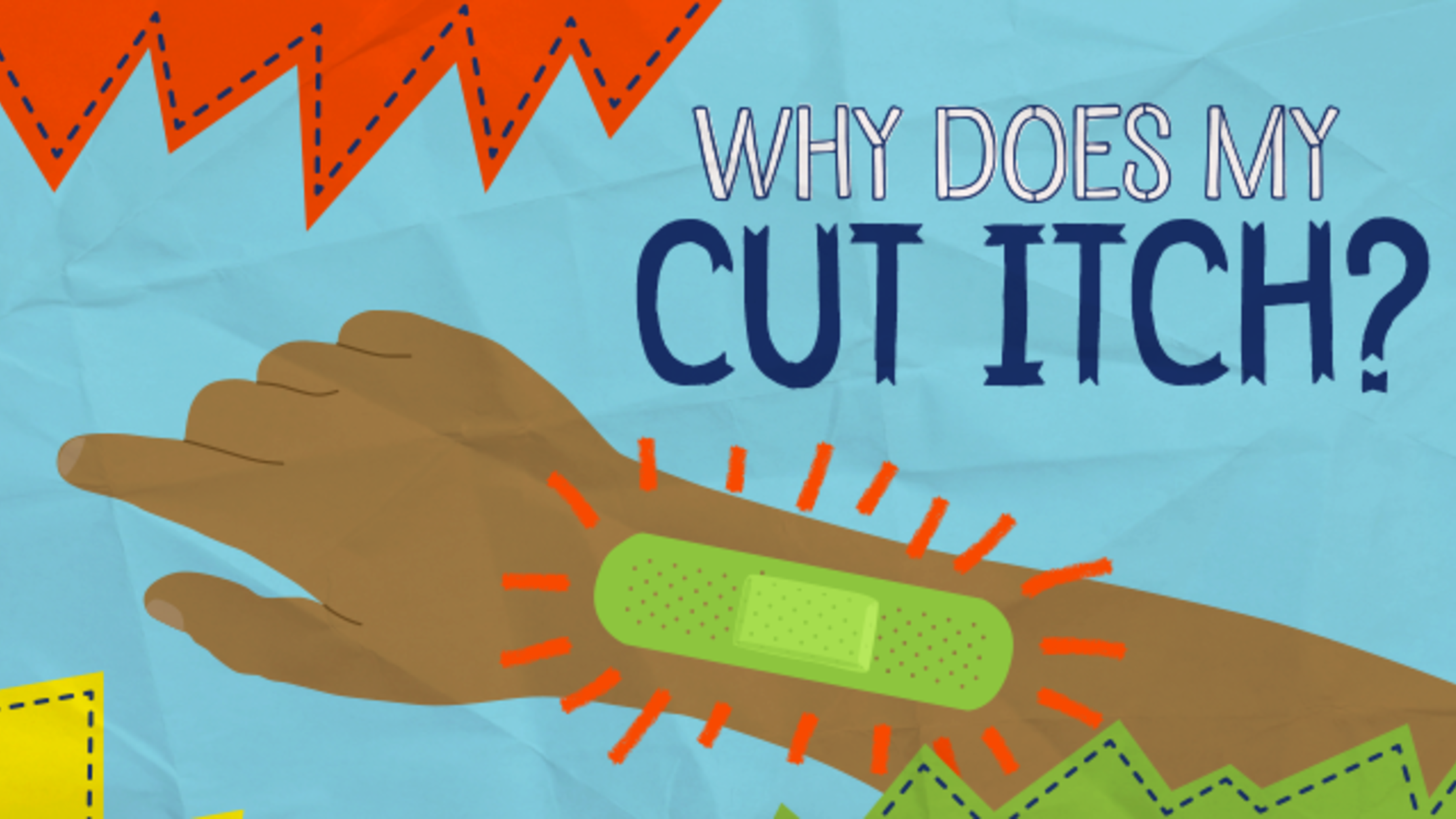 Why Does My Cut Itch? | Mental Floss Why Does My Cut Itch? | Mental Floss