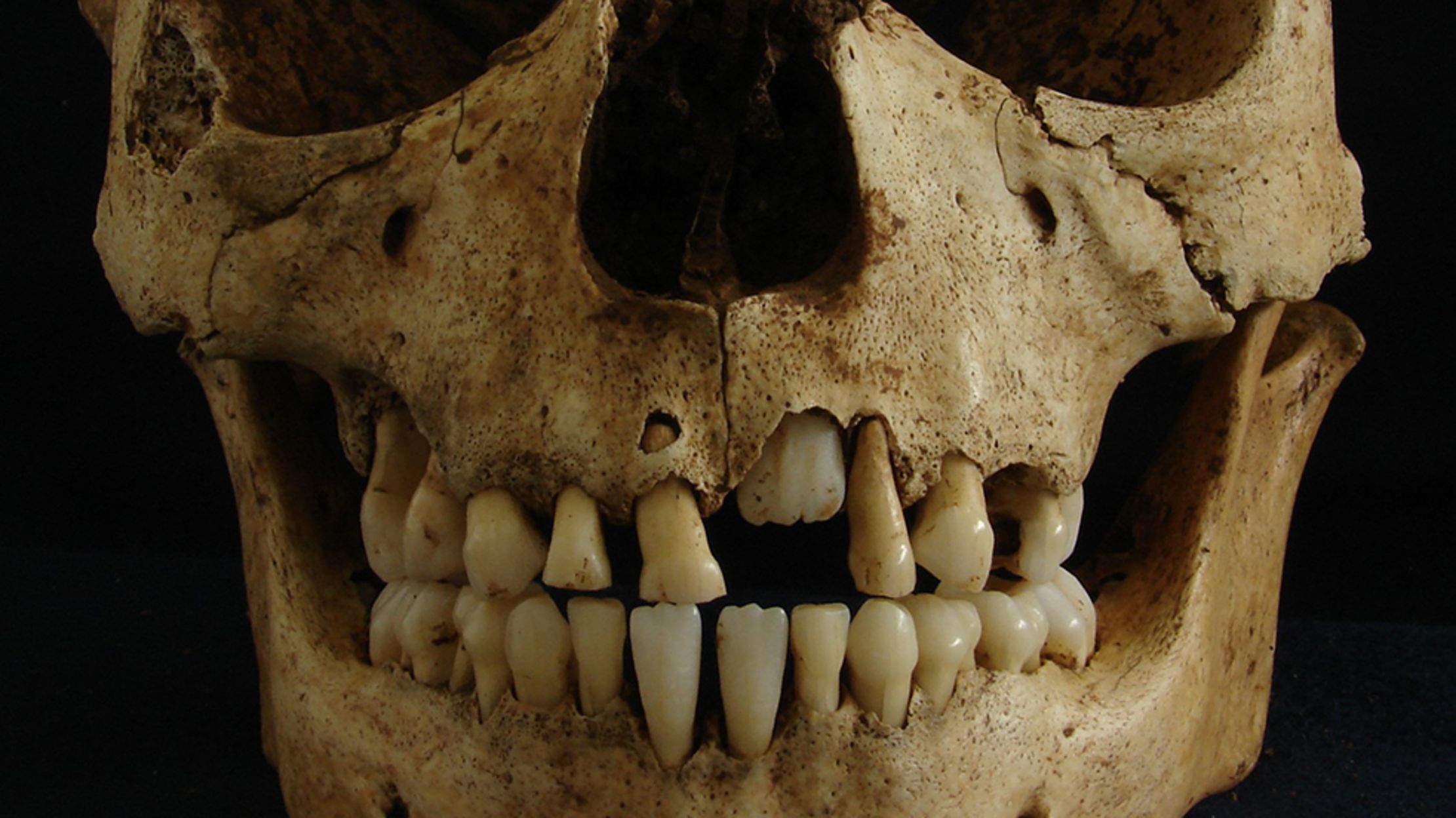 Teeth and Bones from Ancient Rome Hold Clues to Migration and Slavery | Mental Floss Teeth and Bones from Ancient Rome Hold Clues to Migration and Slavery | Mental Floss
