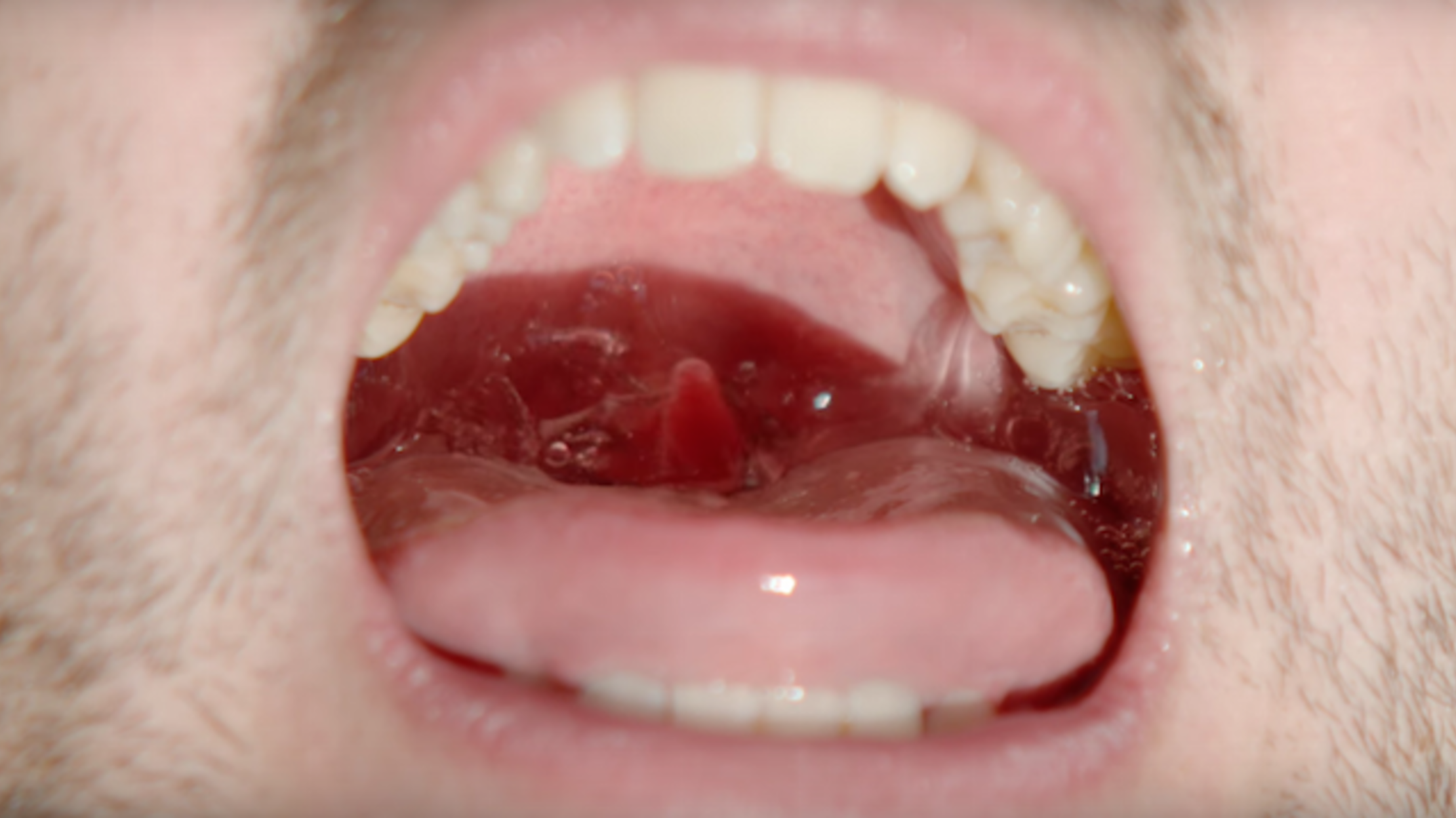 Watch This Slow Motion Video of What Happens When You Gargle Mental Floss