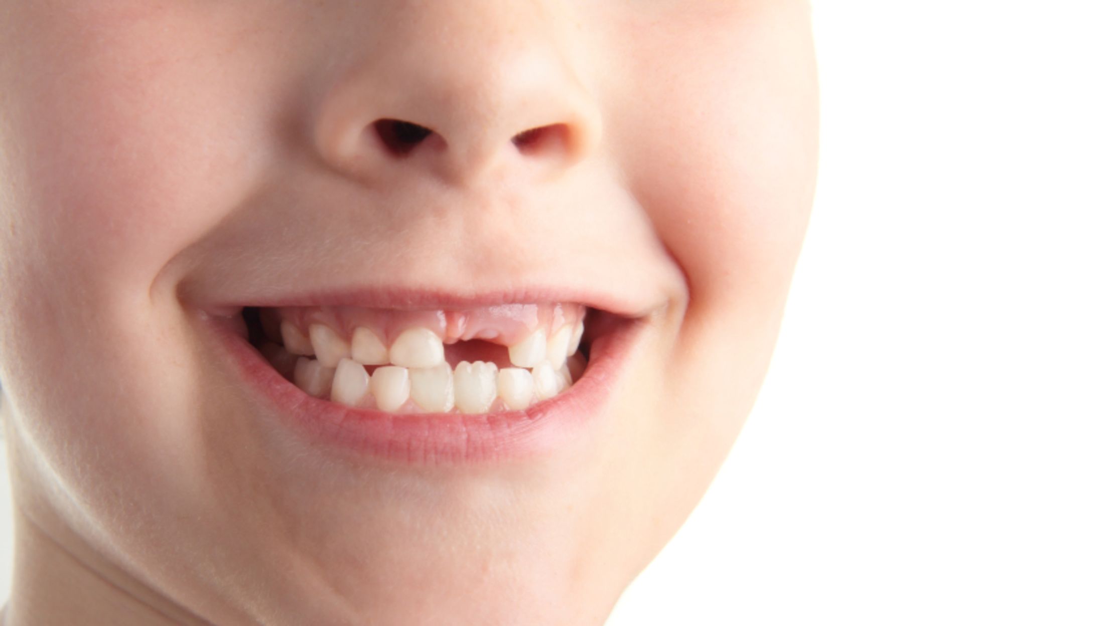 What Happens to Your Tooth After It Gets Extracted? Mental Floss