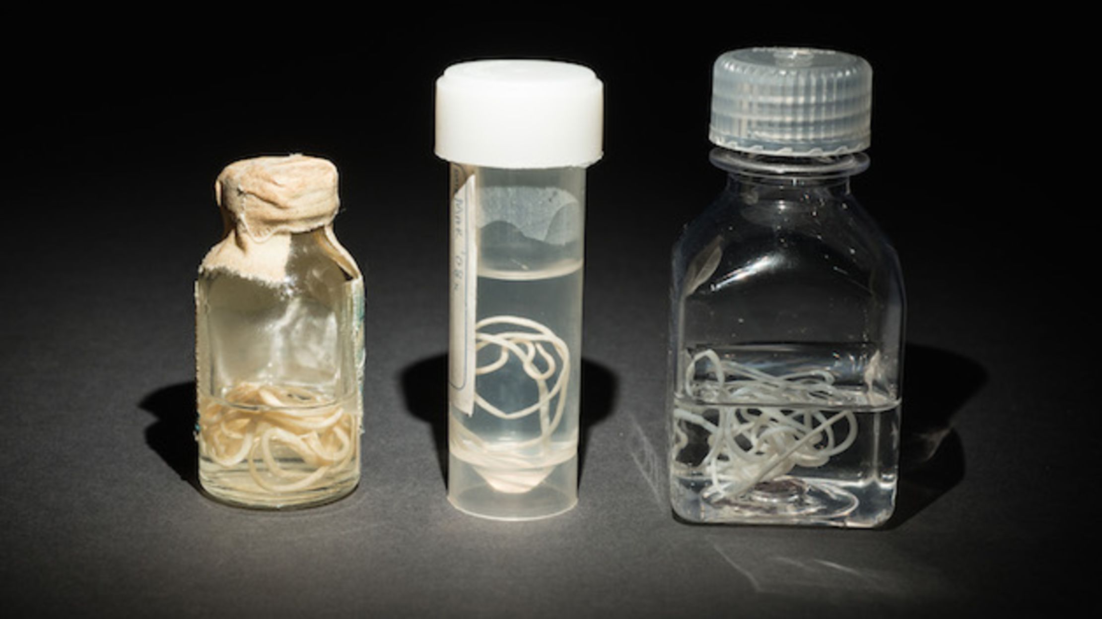 10 Facts About Guinea Worm Disease Mental Floss