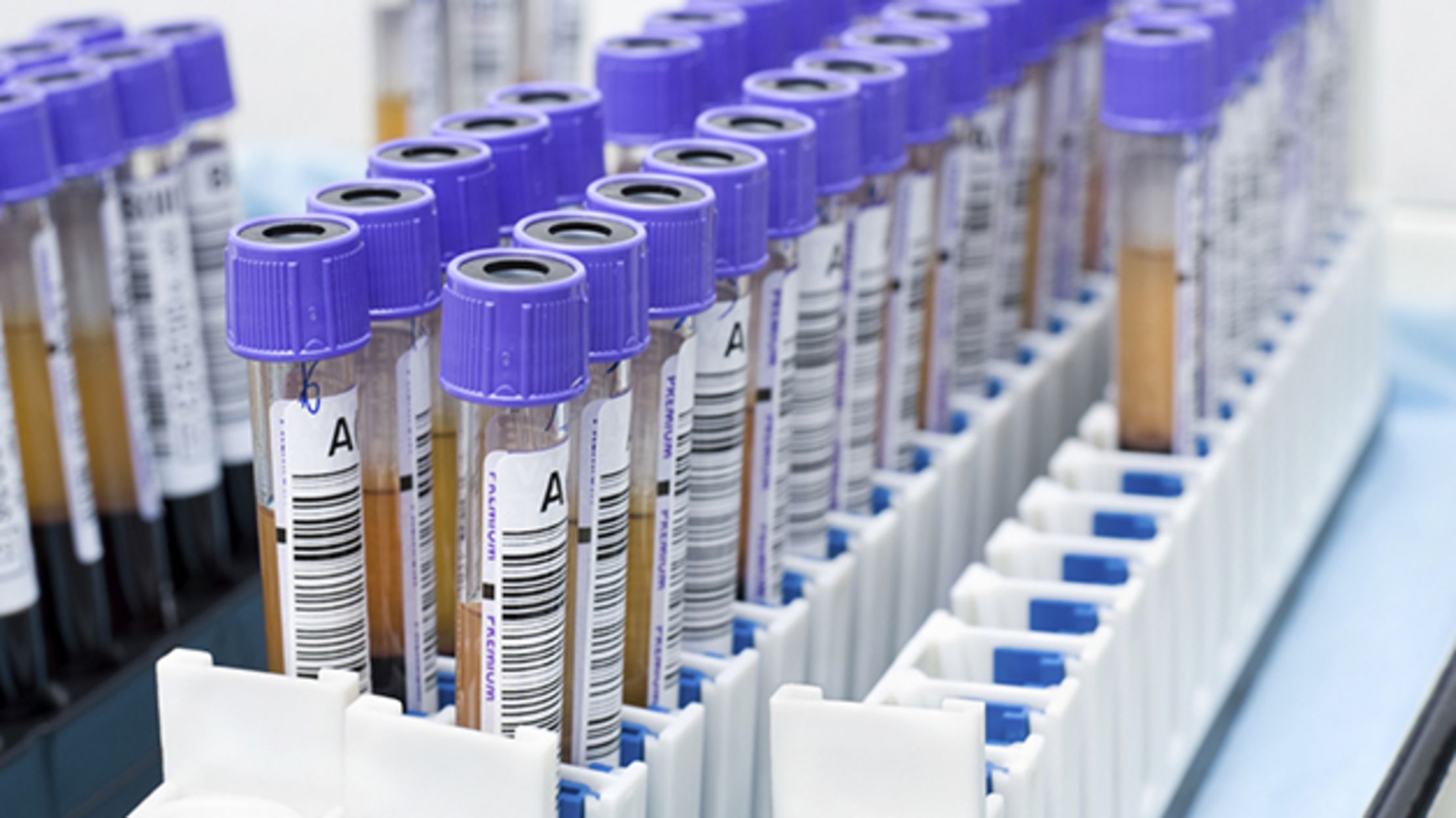 How Is Blood Type Determined Mental Floss