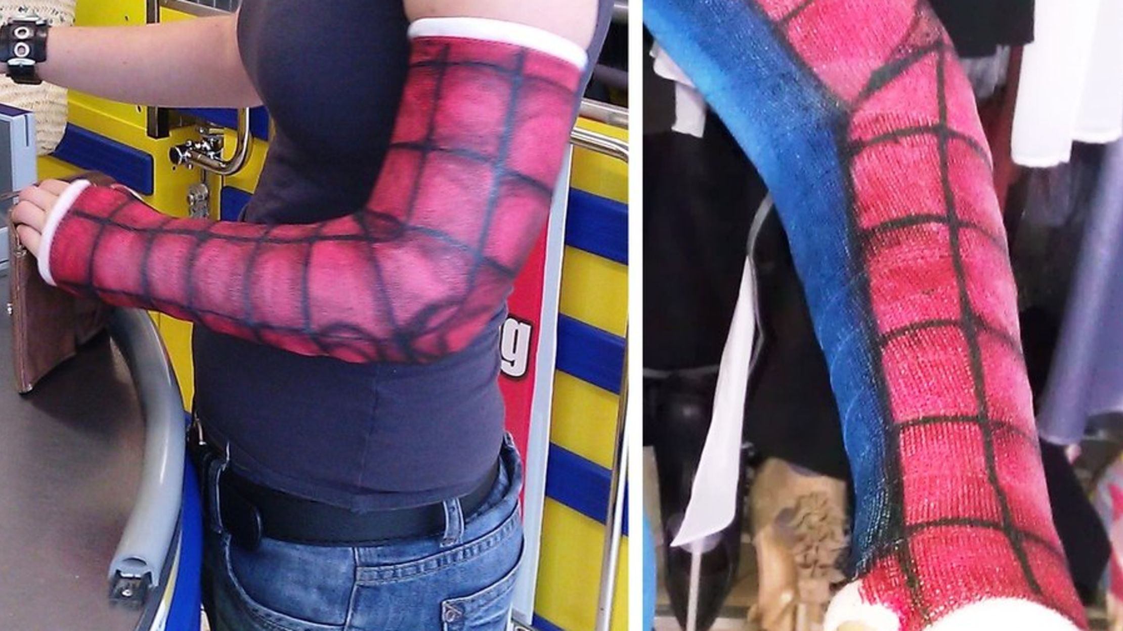 11 Awesomely Decorated Casts Worth A Broken Bone Mental Floss