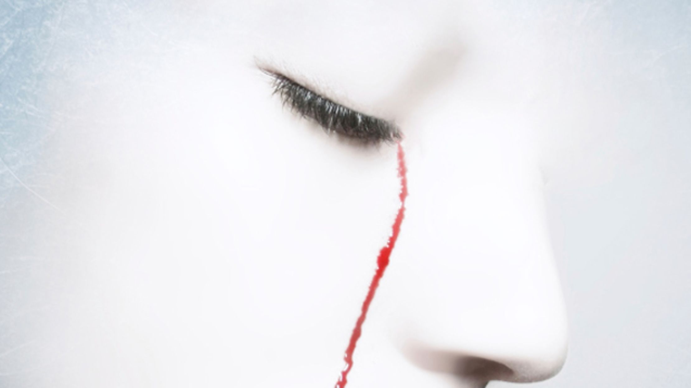 Haemolacria A Rare Condition That Makes People Cry Blood Mental Floss