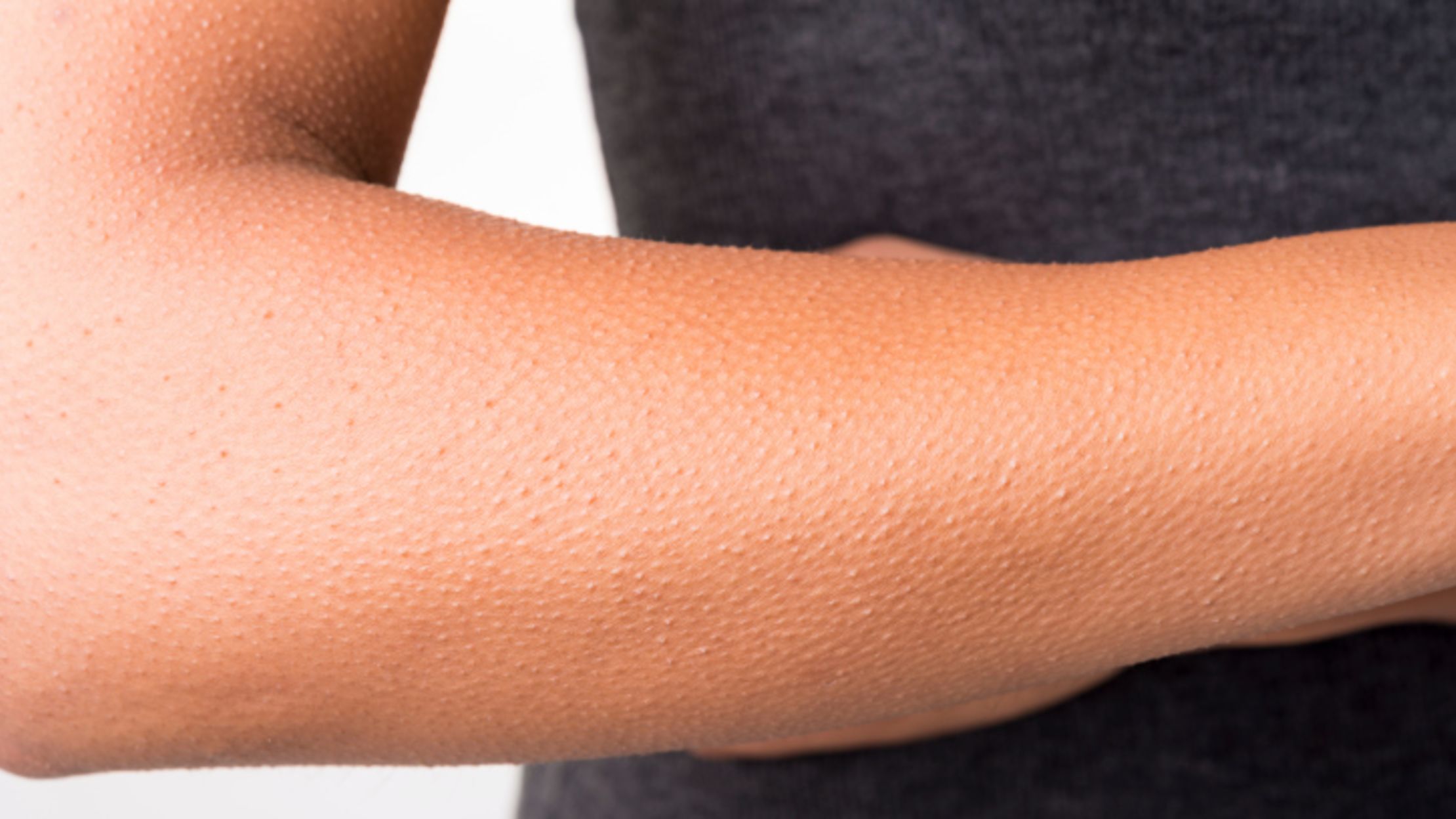 6 Surprising Examples of Human Vestigiality Mental Floss