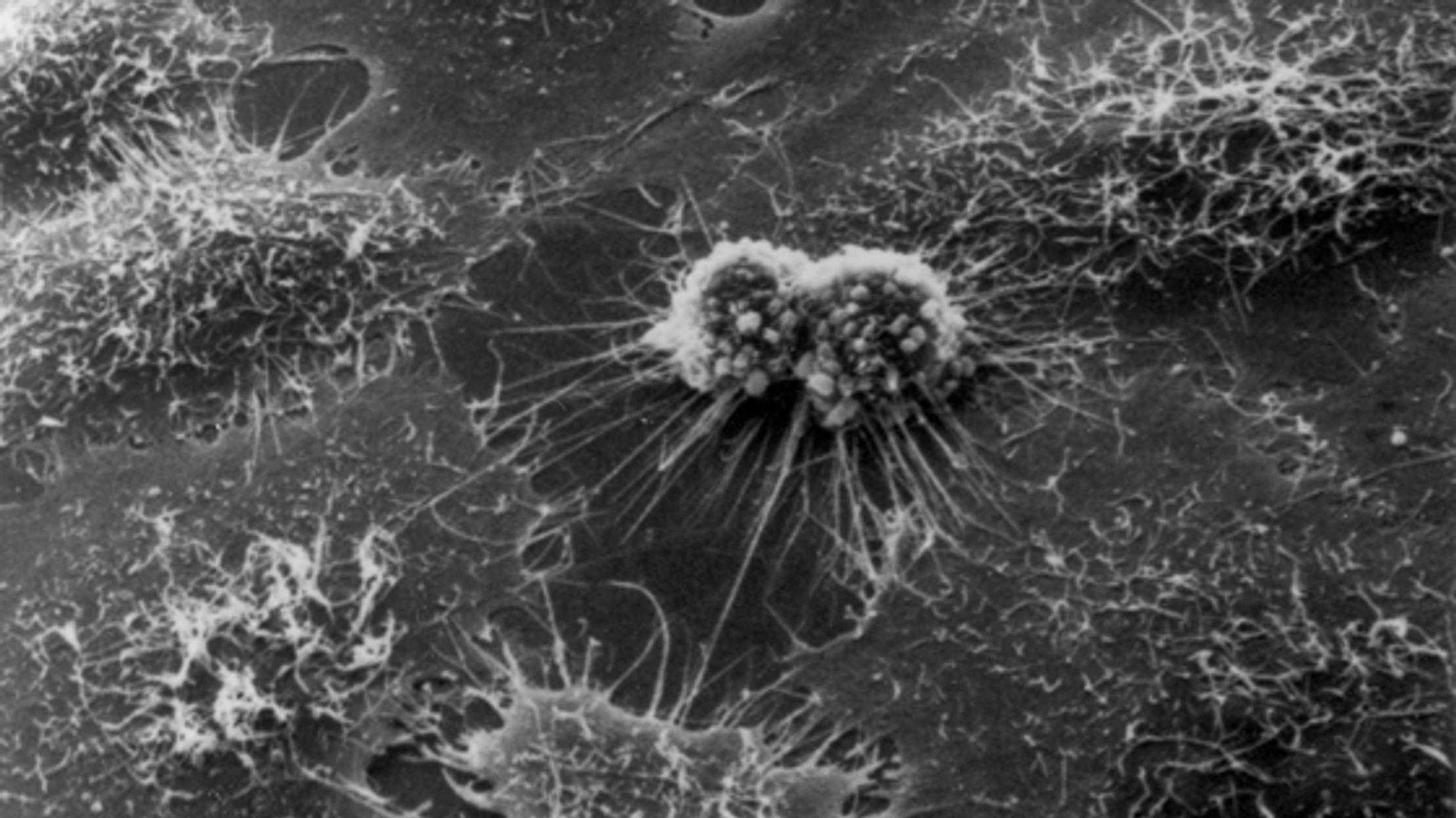 Henrietta Lacks Immortal Cells Mental Floss