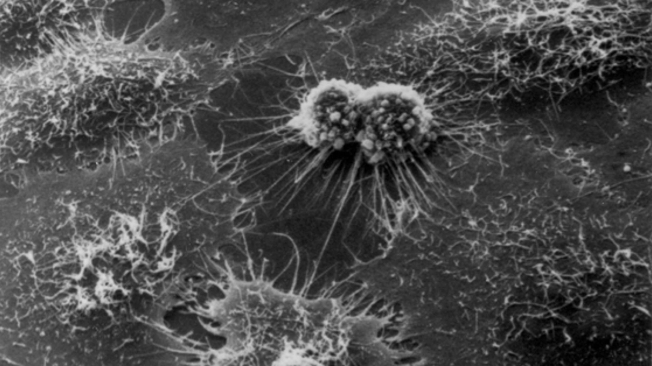 Henrietta Lacks Immortal Cells Mental Floss