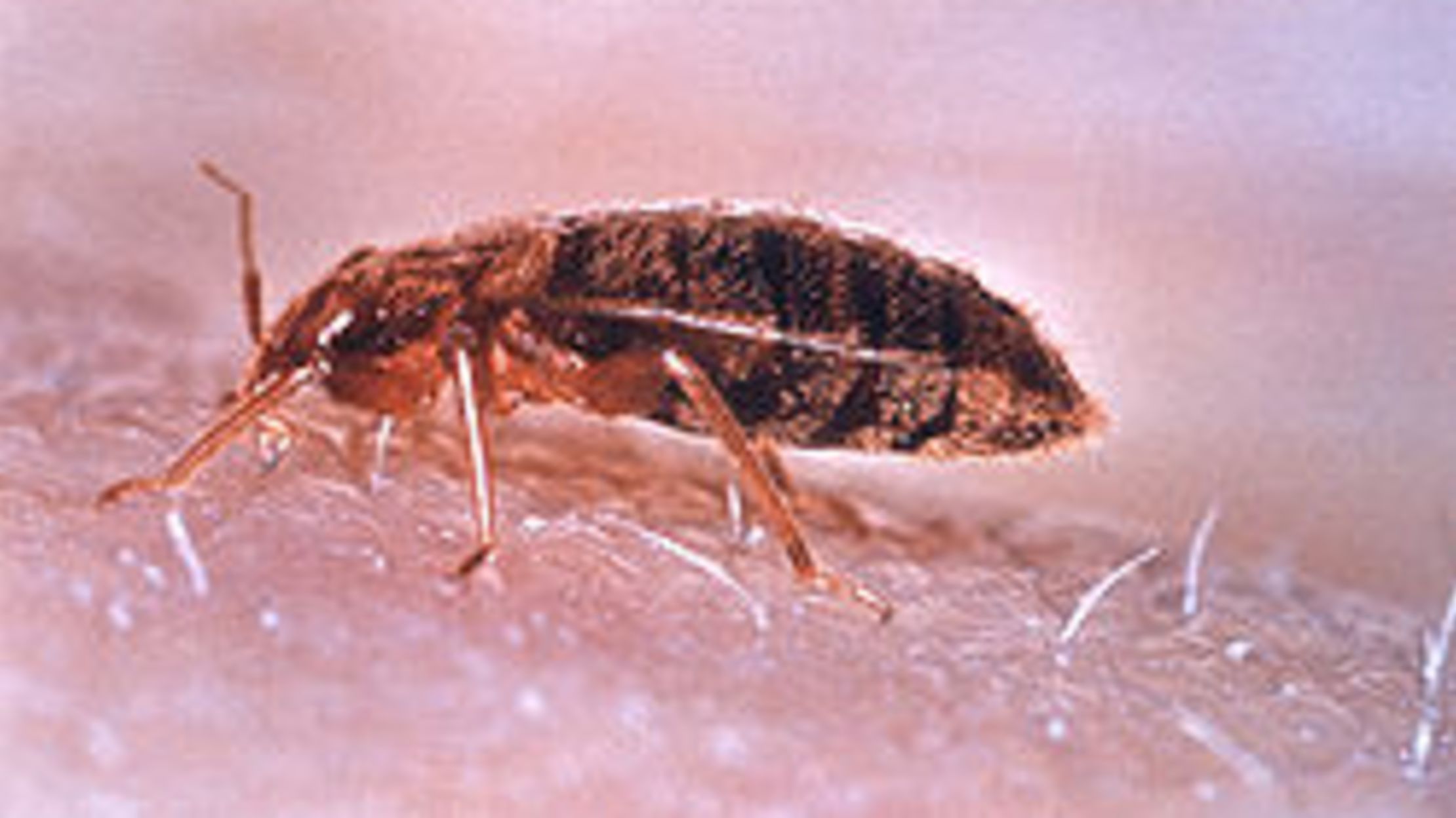 Don't let the bedbugs bite! (No, seriously.) Mental Floss