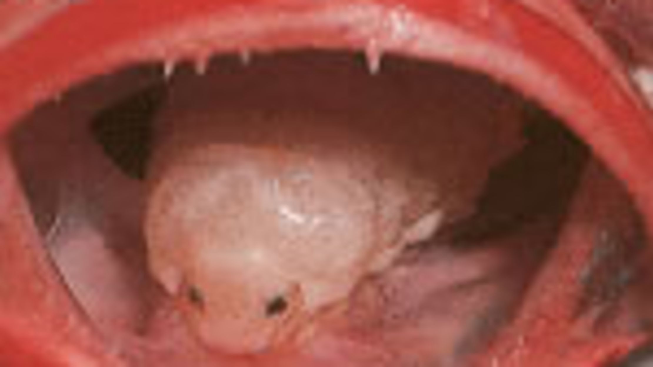 6 Horrifying Parasites (Kevin Federline isn't one of them ...